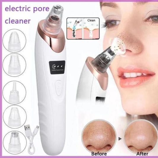 Face Vacuum Suction Blackhead Remover Pore Cleaner ...?