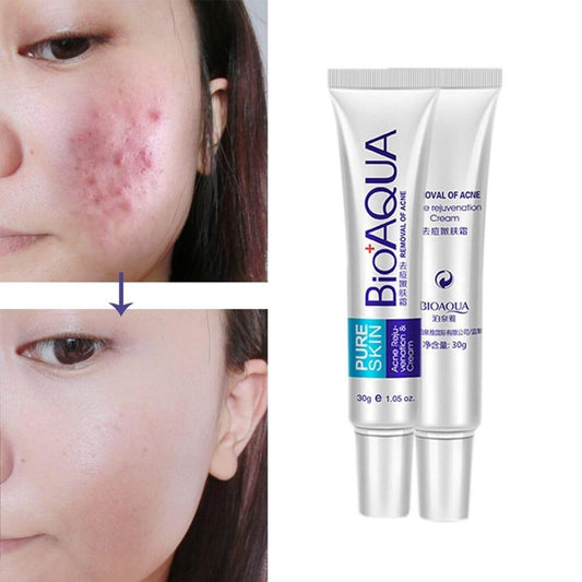 Acne Scar Removal Cream 30g Pure Skin BioAqua...?
